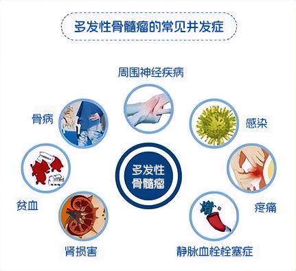 M蛋白上演消失的她?——淺談多發性骨髓瘤的診斷與療效評估 M蛋白上演消失的她?——淺談多發性骨髓瘤的診斷與療效評估